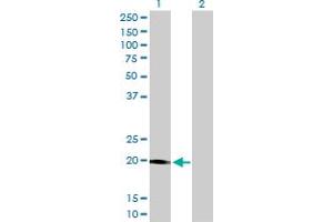 Western Blot analysis of STK32A expression in transfected 293T cell line by STK32A monoclonal antibody (M01), clone 3E8-1D3.