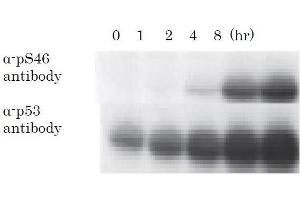 Western Blotting (WB) image for anti-Tumor Protein P53 (TP53) (pSer46) antibody (ABIN3201005)