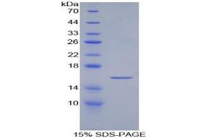 SDS-PAGE analysis of Artemin Protein. (ARTN Protein)