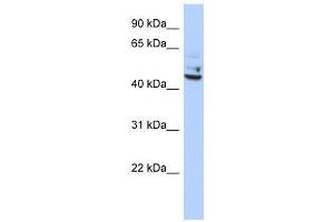 Western Blot showing TP53I13 antibody used at a concentration of 1-2 ug/ml to detect its target protein.