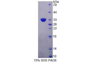 SDS-PAGE analysis of Human PLIN4 Protein.