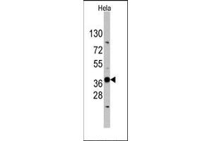 Image no. 1 for anti-Ectodysplasin A (EDA) (N-Term) antibody (ABIN358789) (Ectodysplasin A Antikörper  (N-Term))