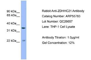 WB Suggested Anti-ZDHHC21  Antibody Titration: 0. (ZDHHC21 Antikörper  (Middle Region))