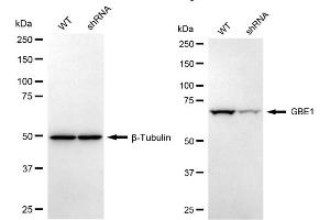 Western blotting analysis using GBE1 antibody (ABIN7798727). (GBE1 Antikörper)