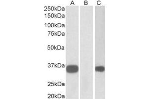 Western Blotting (WB) image for anti-Abhydrolase Domain Containing 14B (ABHD14B) (Internal Region) antibody (ABIN2465095) (ABHD14B Antikörper  (Internal Region))