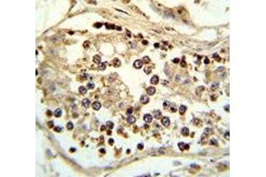 IHC analysis of FFPE human testis tissue stained with ABHD12 antibody (ABHD12 Antikörper  (AA 40-66))