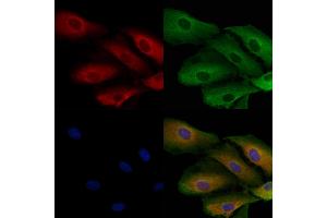 ABIN7093965 and ABIN7098009 staining  cells by IF/ICC. (PSPH Antikörper  (Internal Region))
