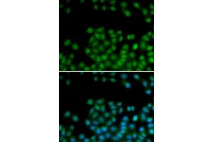 Immunofluorescence analysis of HeLa cells using SFRP2 antibody (ABIN5973117). (SFRP2 Antikörper)