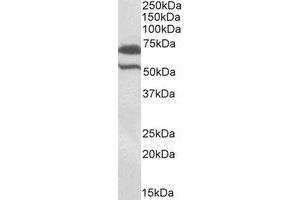 Western Blotting (WB) image for anti-Baculoviral IAP Repeat Containing 3 (BIRC3) (Internal Region) antibody (ABIN2464738) (BIRC3 Antikörper  (Internal Region))