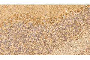 Immunohistochemistry (IHC) image for anti-Vascular Endothelial Growth Factor A (VEGFA) (AA 27-214) antibody (ABIN7428479)