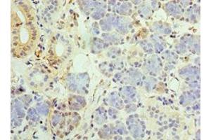 Immunohistochemistry of paraffin-embedded human pancreatic tissue using ABIN7159831 at dilution of 1:100 (UCP1 Antikörper  (AA 1-307))
