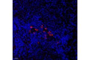 Immunofluorescence of paraffin embedded rat spleen using CNG1 (ABIN7073608) at dilution of 1:700 (400x lens) (CNGA1 Antikörper)