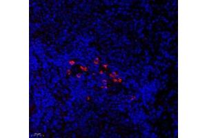 Immunofluorescence of paraffin embedded rat spleen using CNG1 (ABIN7073608) at dilution of 1:700 (400x lens) (CNGA1 Antikörper)