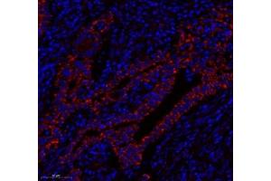 Immunofluorescence (Paraffin-embedded Sections) (IF (p)) image for anti-Heat Shock 60kDa Protein 1 (Chaperonin) (HSPD1) antibody (ABIN7074167)