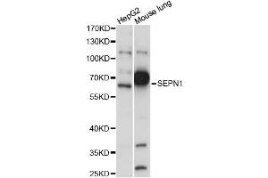 Western blot analysis of extracts of various cell lines, using SEPN1 antibody (ABIN6289941) at 1:1000 dilution. (Selenoprotein N Antikörper)