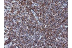 Immunohistochemistry (IHC) image for anti-T-cell surface glycoprotein CD1c (CD1C) antibody (ABIN1497187) (CD1c Antikörper)