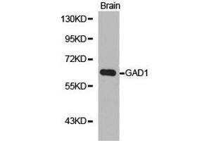 Western Blotting (WB) image for anti-Glutamate Decarboxylase 1 (Brain, 67kDa) (GAD1) antibody (ABIN1872765)
