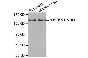 Western blot analysis of extracts from rat and mouse brain tissue using Phospho-NTRK1-S791 antibody (ABIN2987788). (TRKA Antikörper  (pSer791))