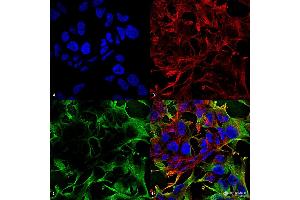 Immunocytochemistry/Immunofluorescence analysis using Mouse Anti-Neuroligin 3 Monoclonal Antibody, Clone S110-29 . (Neuroligin 3 Antikörper  (AA 730-848) (Atto 488))