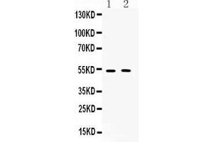 Western blot analysis of CHRM2 expression in rat brain extract ( Lane 1) and mouse brain extract ( Lane 2).