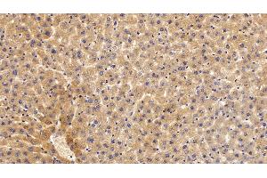 Immunohistochemistry (IHC) image for anti-Cytochrome P450, Family 1, Subfamily A, Polypeptide 1 (CYP1A1) (AA 251-521) antibody (ABIN7441016)