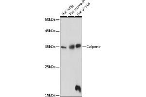 Western blot analysis of extracts of various cell lines, using Calponin antibody (ABIN7266040) at 1:1000 dilution. (CNN1 Antikörper  (AA 130-180))