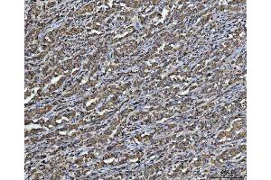 IHC analysis of ARL13B using anti-ARL13B antibody (ABIN7600179). (ARL13B Antikörper  (AA 16-428))