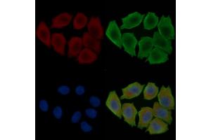 ABIN6263901 and ABIN6278065 staining Hela cells(30 min of UV treatment) by IF/ICC.