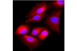 Immunofluorescence (IF) image for anti-N-Acetyltransferase 6 (GCN5-Related) (NAT6) (AA 1-308), (N-Term) antibody (ABIN452459) (NAT6 Antikörper  (N-Term))
