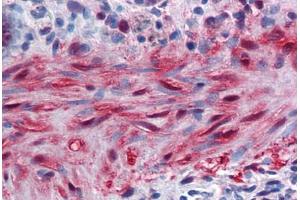 Human Colon, muscularis mucosa: Formalin-Fixed, Paraffin-Embedded (FFPE) (YAP1 Antikörper  (AA 53-162))