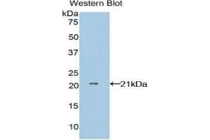 Western Blotting (WB) image for anti-Non-Metastatic Cells 1, Protein (NM23A) Expressed in (NME1) (AA 1-152) antibody (ABIN1860003)