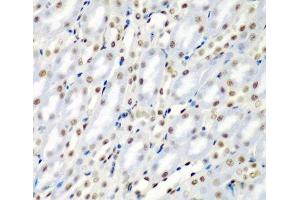 Immunohistochemistry of paraffin-embedded Mouse kidney using SF3B3 Polyclonal Antibody at dilution of 1:200 (40x lens).