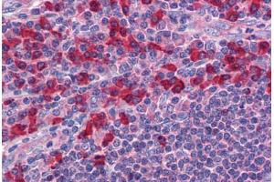 Immunohistochemistry (Formalin-fixed Paraffin-embedded Sections) (IHC (fp)) image for anti-Toll-Like Receptor 7 (TLR7) (AA 465-483) antibody (ABIN6745769)