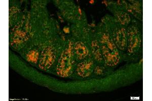 Formalin-fixed and paraffin-embedded mouse intestine labeled with Anti-PAI1/PLANH1/Serpine 1 Polyclonal Antibody, Unconjugated (ABIN718106) 1:200, overnight at 4°C, The secondary antibody was Goat Anti-Rabbit IgG, Cy3 conjugated used at 1:200 dilution for 40 minutes at 37°C. (PAI1 Antikörper  (AA 251-350))