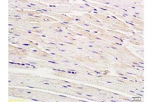 Formalin-fixed and paraffin embedded rat myocardium tissue labeled with Anti-Connexin-40 Polyclonal Antibody, Unconjugated  at 1:200, followed by conjugation to the secondary antibody and DAB staining (Cx40/GJA5 Antikörper  (AA 301-358))