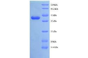 Tax1 (Human T-Cell Leukemia Virus Type I) Binding Protein 3 (TAX1BP3) (AA 1-124), (full length) protein (GST tag) (TAX1BP3 Protein (AA 1-124, full length) (GST tag))