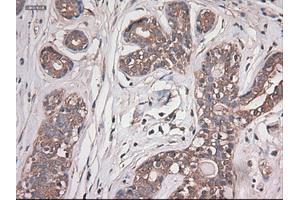 Immunohistochemistry (IHC) image for anti-Carboxypeptidase A1 (Pancreatic) (CPA1) (AA 1-419) antibody (ABIN1490771) (CPA1 Antikörper  (AA 1-419))