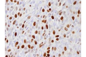 Immunohistochemistry (IHC) image for anti-Minichromosome Maintenance Complex Component 2 (MCM2) (pSer108) antibody (ABIN7448988) (MCM2 Antikörper  (pSer108))