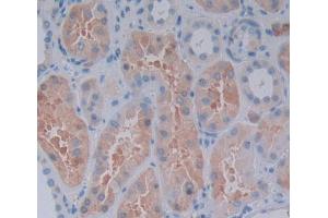 Used in DAB staining on fromalin fixed paraffin- embedded Kidney tissue (RIPK2 Antikörper  (AA 432-540))