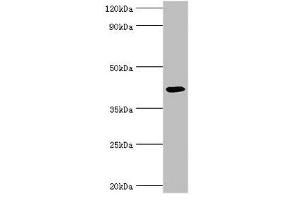 Western blot All lanes: Alkylated DNA repair protein alkB homolog 1 antibody at 9 μg/mL + Mouse kidney tissue Secondary Goat polyclonal to rabbit IgG at 1/10000 dilution Predicted band size: 44 kDa Observed band size: 44 kDa (ALKBH1 Antikörper  (AA 110-389))