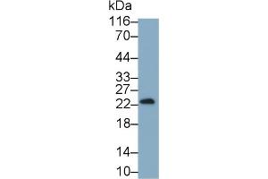 Detection of IFNg in Cavia Testis lysate using Monoclonal Antibody to Interferon Gamma (IFNg) (Interferon gamma Antikörper  (AA 24-166))