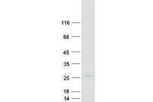 Western Blotting (WB) image for Transmembrane Protein 11 (TMEM11) (Transcript Variant 1) protein (Myc-DYKDDDDK Tag) (ABIN2733843)