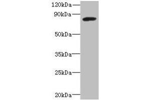 Western blot All lanes: PBXIP1 antibody at 4 μg/mL + A549 whole cell lysate Secondary Goat polyclonal to rabbit IgG at 1/10000 dilution Predicted band size: 81, 78, 73 kDa Observed band size: 81 kDa (PBXIP1 Antikörper  (AA 361-600))