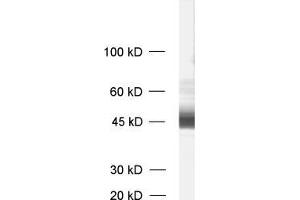 dilution: 1 : 1000, sample: synaptic membrane fraction of rat brain (LP1) (MCTS1 Antikörper)