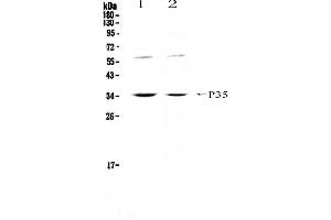 Western blot analysis of IL12A using anti-IL12A antibody . (IL12A Antikörper  (AA 23-215))