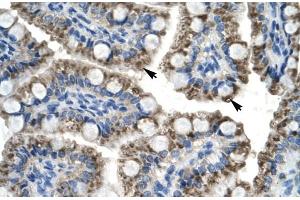 Rabbit Anti-C20orf100 Antibody Catalog Number: ARP30008 Paraffin Embedded Tissue: Human Intestine Cellular Data: Epithelial cells of intestinal villas Antibody Concentration: 4. (TOX2 Antikörper  (N-Term))