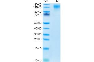 SDS-PAGE (SDS) image for CD96 (CD96) (AA 22-536) protein (His tag) (ABIN7274276)