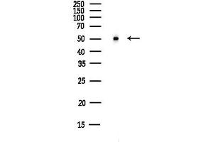 Western blot analysis of lysates from HUVEC cells(UV,30 min treatment), using IPCEF1 Antibody at 1/1000 dilution.