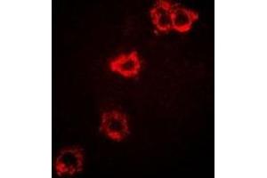Immunofluorescent analysis of STS-1 staining in SKOV3 cells.