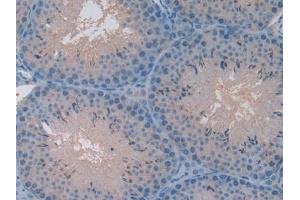 Immunohistochemistry (IHC) image for anti-Pro-Platelet Basic Protein (Chemokine (C-X-C Motif) Ligand 7) (PPBP) (AA 40-113) antibody (ABIN7431662)
